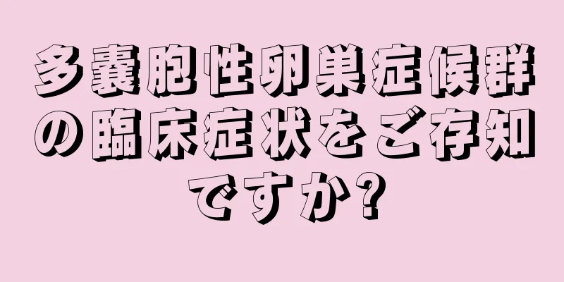 多嚢胞性卵巣症候群の臨床症状をご存知ですか?