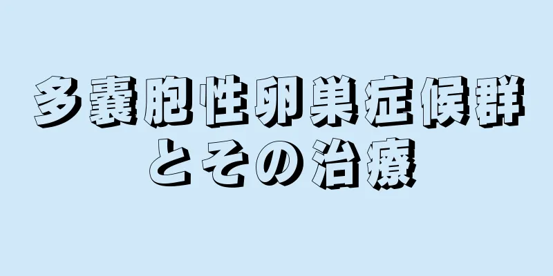 多嚢胞性卵巣症候群とその治療