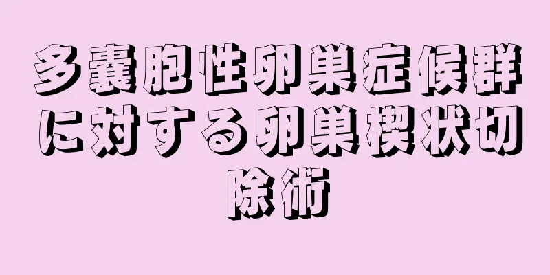 多嚢胞性卵巣症候群に対する卵巣楔状切除術