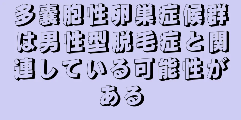 多嚢胞性卵巣症候群は男性型脱毛症と関連している可能性がある