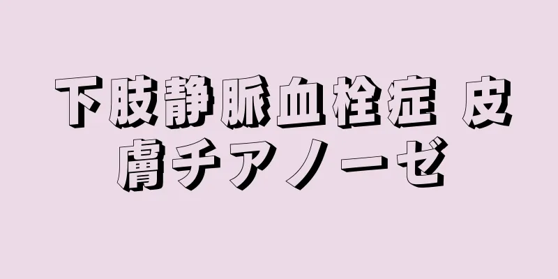 下肢静脈血栓症 皮膚チアノーゼ
