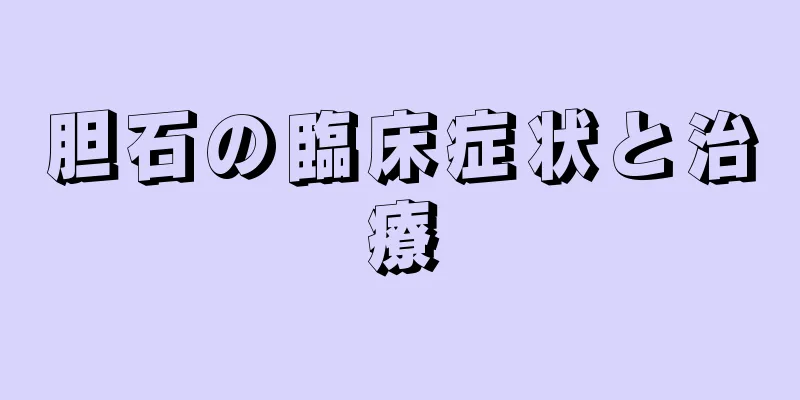 胆石の臨床症状と治療