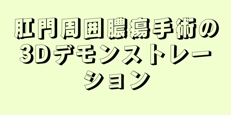 肛門周囲膿瘍手術の3Dデモンストレーション