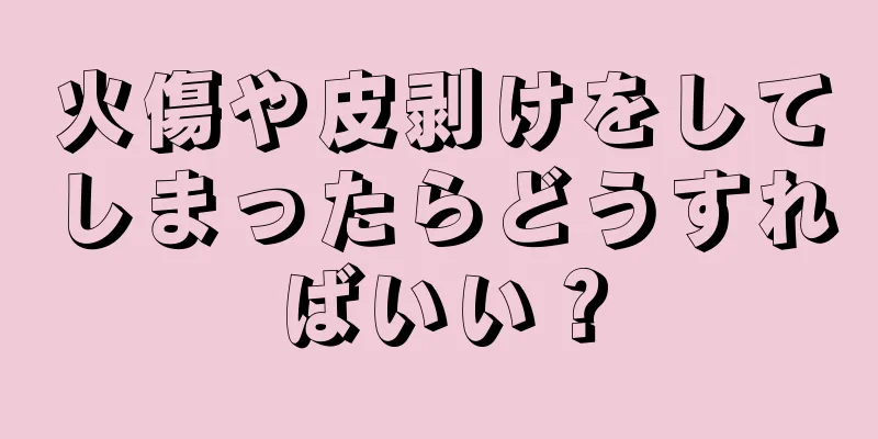 火傷や皮剥けをしてしまったらどうすればいい？