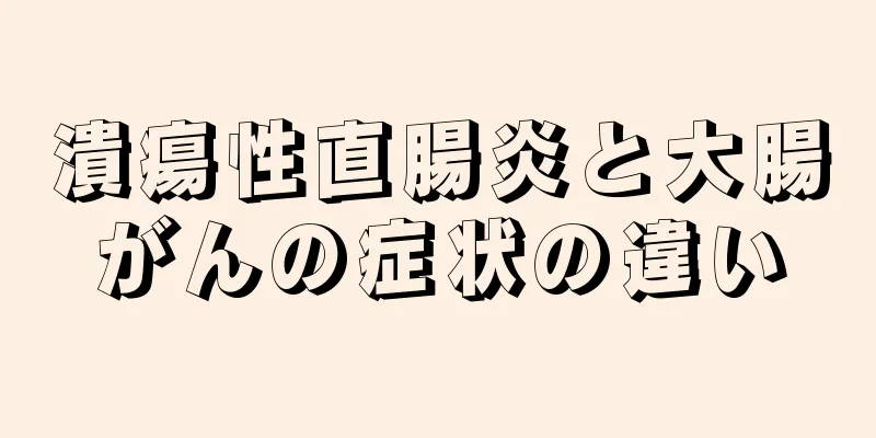 潰瘍性直腸炎と大腸がんの症状の違い