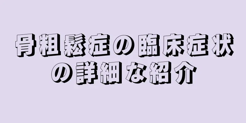 骨粗鬆症の臨床症状の詳細な紹介