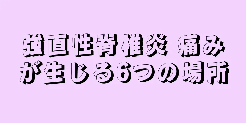 強直性脊椎炎 痛みが生じる6つの場所