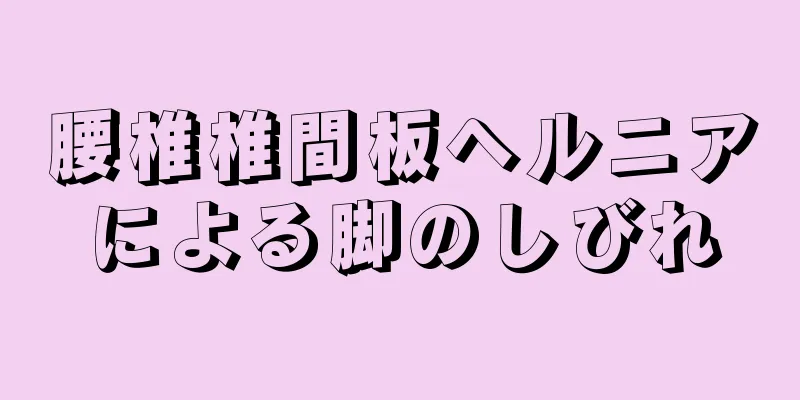 腰椎椎間板ヘルニアによる脚のしびれ