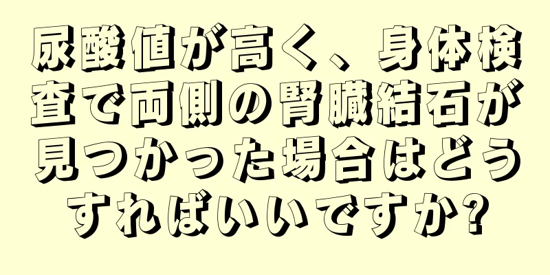 尿酸値が高く、身体検査で両側の腎臓結石が見つかった場合はどうすればいいですか?