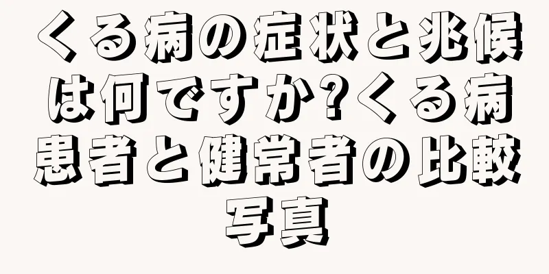 くる病の症状と兆候は何ですか?くる病患者と健常者の比較写真