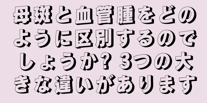 母斑と血管腫をどのように区別するのでしょうか? 3つの大きな違いがあります