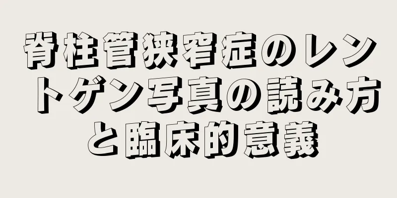 脊柱管狭窄症のレントゲン写真の読み方と臨床的意義