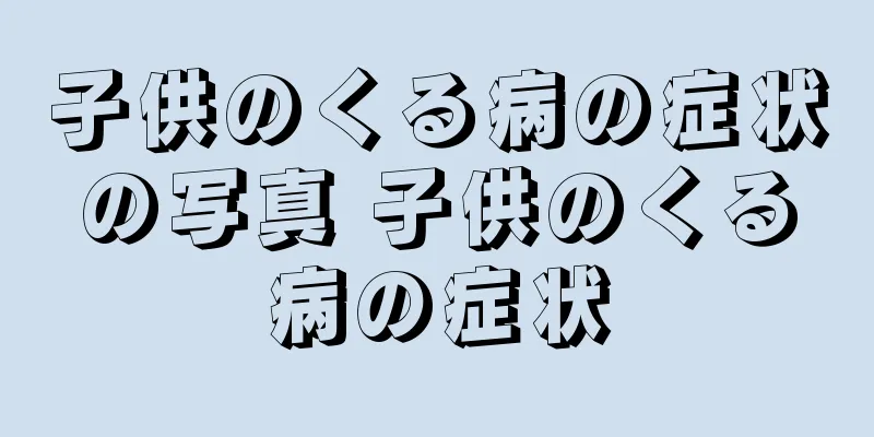 子供のくる病の症状の写真 子供のくる病の症状