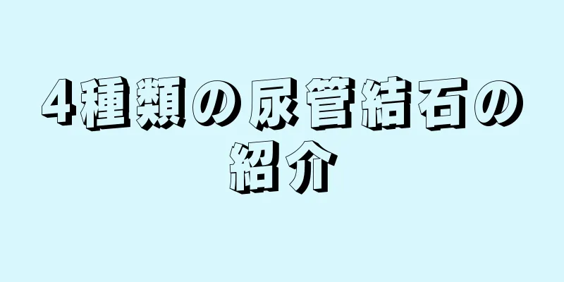 4種類の尿管結石の紹介