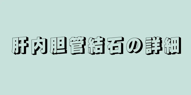 肝内胆管結石の詳細