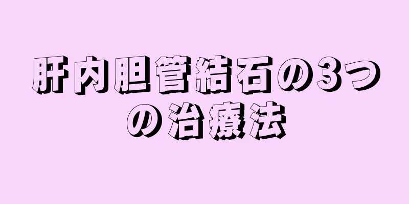 肝内胆管結石の3つの治療法