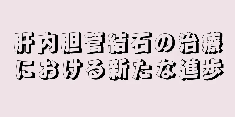肝内胆管結石の治療における新たな進歩