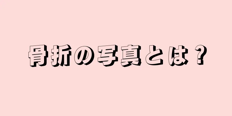 骨折の写真とは？