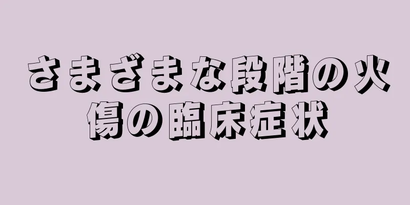 さまざまな段階の火傷の臨床症状