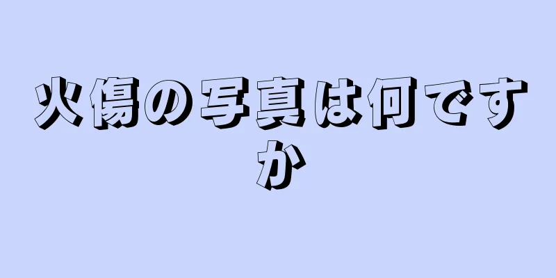 火傷の写真は何ですか