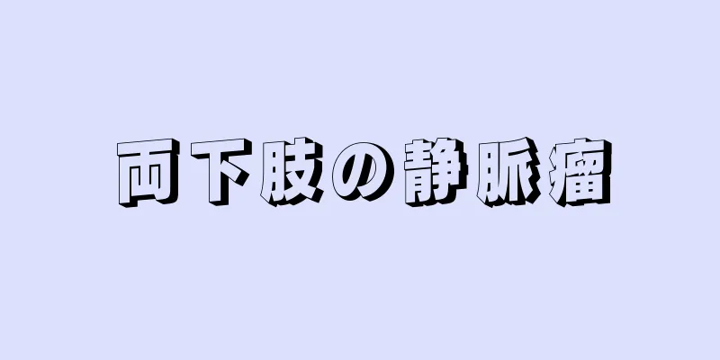両下肢の静脈瘤