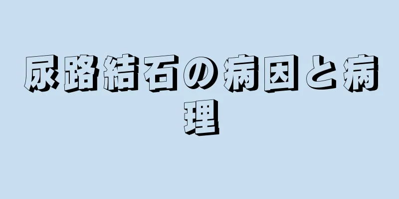 尿路結石の病因と病理