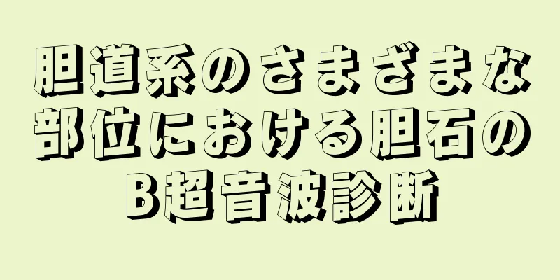 胆道系のさまざまな部位における胆石のB超音波診断