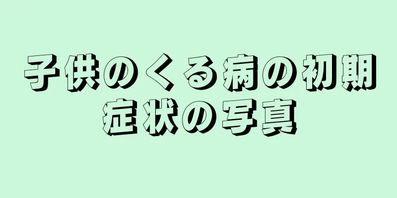 子供のくる病の初期症状の写真