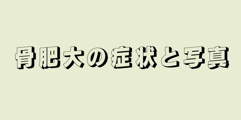 骨肥大の症状と写真