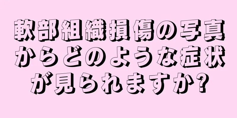 軟部組織損傷の写真からどのような症状が見られますか?