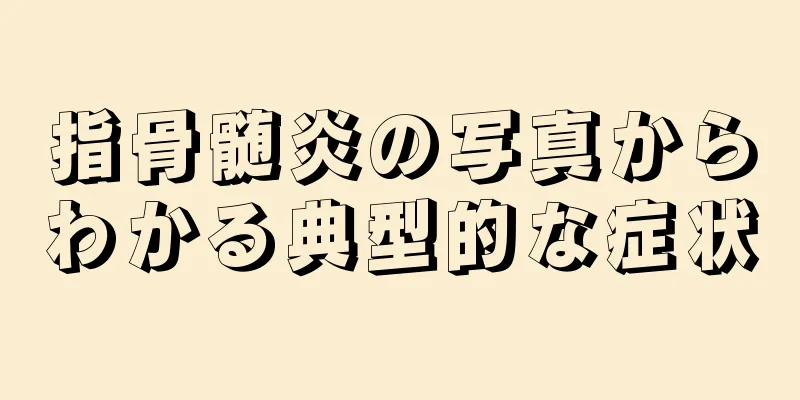 指骨髄炎の写真からわかる典型的な症状