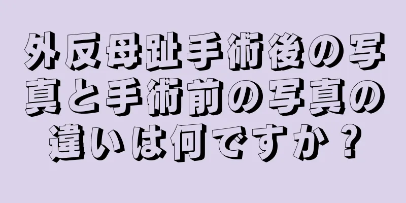 外反母趾手術後の写真と手術前の写真の違いは何ですか？