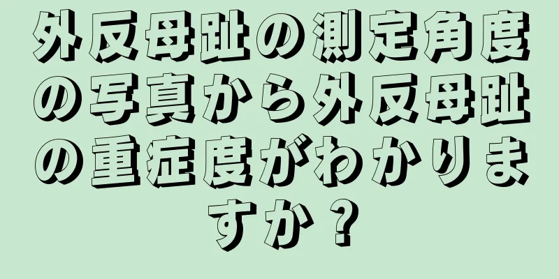 外反母趾の測定角度の写真から外反母趾の重症度がわかりますか？