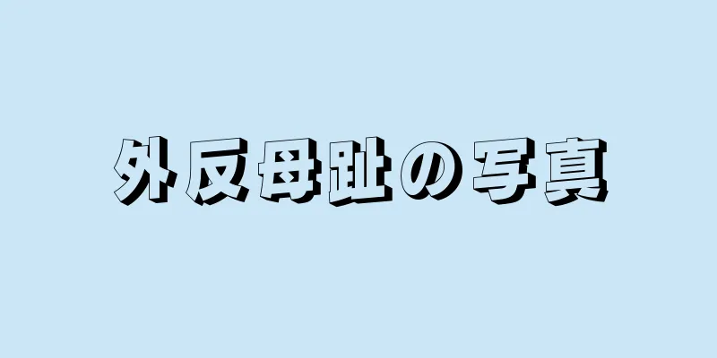 外反母趾の写真
