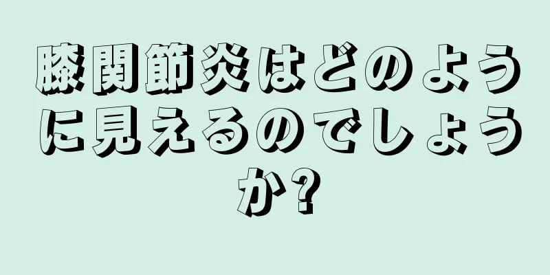 膝関節炎はどのように見えるのでしょうか?