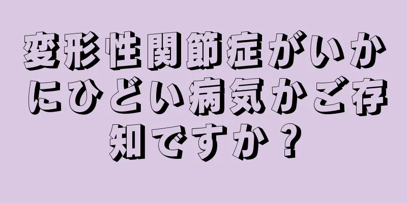 変形性関節症がいかにひどい病気かご存知ですか？
