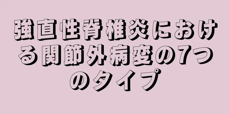 強直性脊椎炎における関節外病変の7つのタイプ
