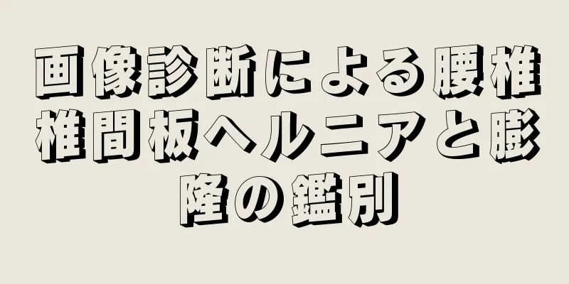 画像診断による腰椎椎間板ヘルニアと膨隆の鑑別