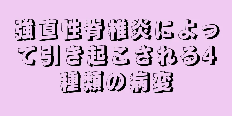 強直性脊椎炎によって引き起こされる4種類の病変