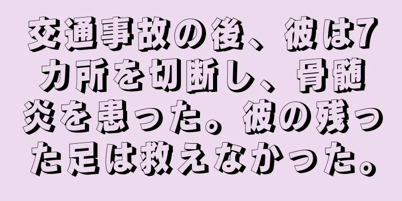 交通事故の後、彼は7カ所を切断し、骨髄炎を患った。彼の残った足は救えなかった。
