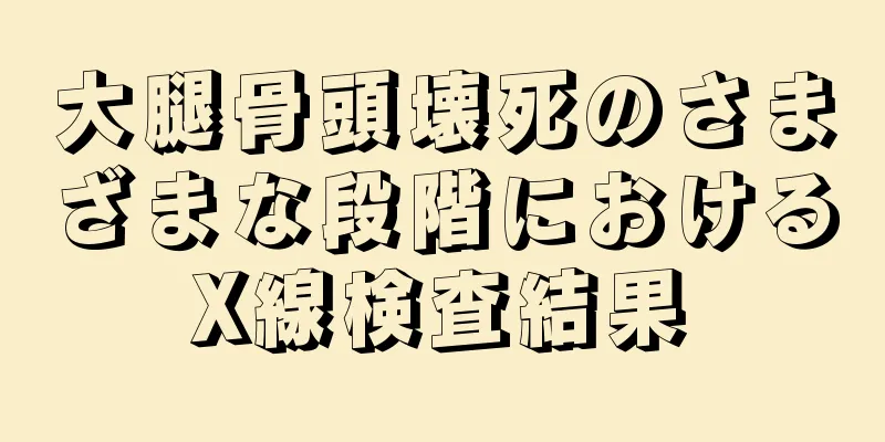 大腿骨頭壊死のさまざまな段階におけるX線検査結果