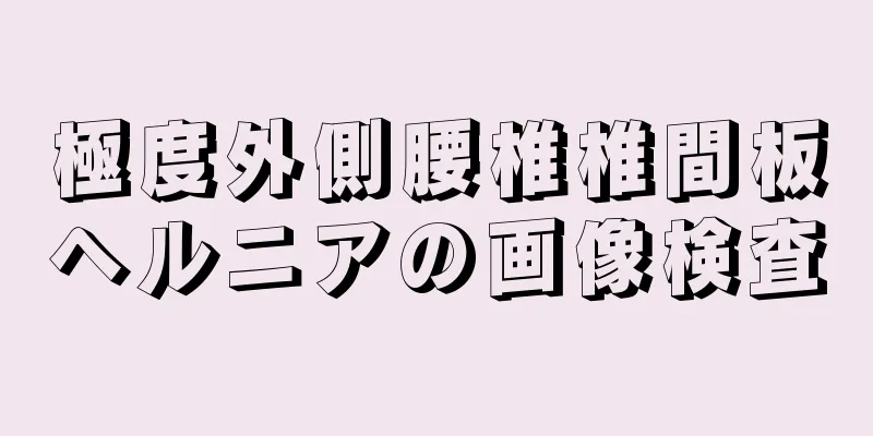 極度外側腰椎椎間板ヘルニアの画像検査