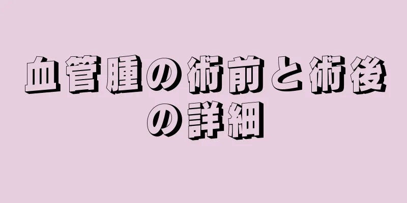 血管腫の術前と術後の詳細