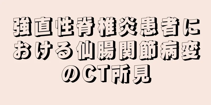 強直性脊椎炎患者における仙腸関節病変のCT所見