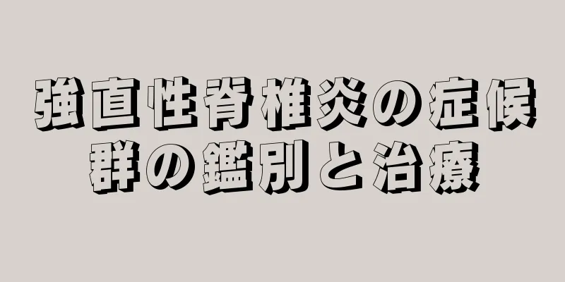 強直性脊椎炎の症候群の鑑別と治療