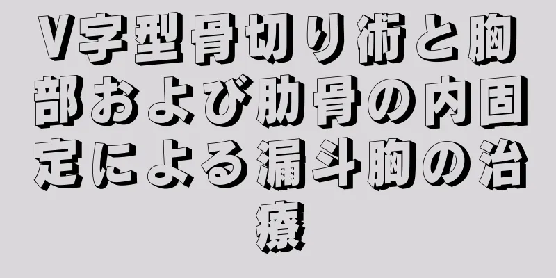 V字型骨切り術と胸部および肋骨の内固定による漏斗胸の治療