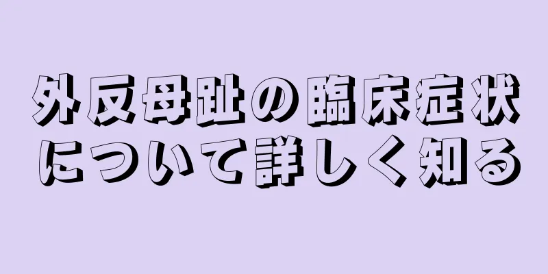 外反母趾の臨床症状について詳しく知る