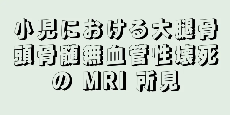 小児における大腿骨頭骨髄無血管性壊死の MRI 所見