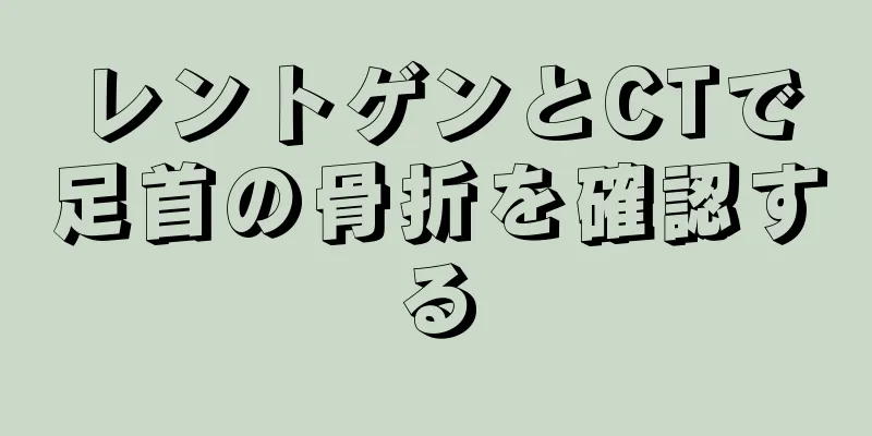 レントゲンとCTで足首の骨折を確認する