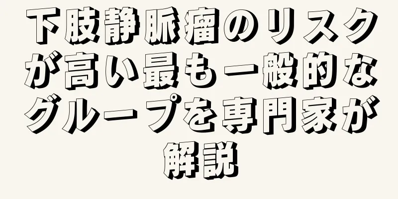 下肢静脈瘤のリスクが高い最も一般的なグループを専門家が解説